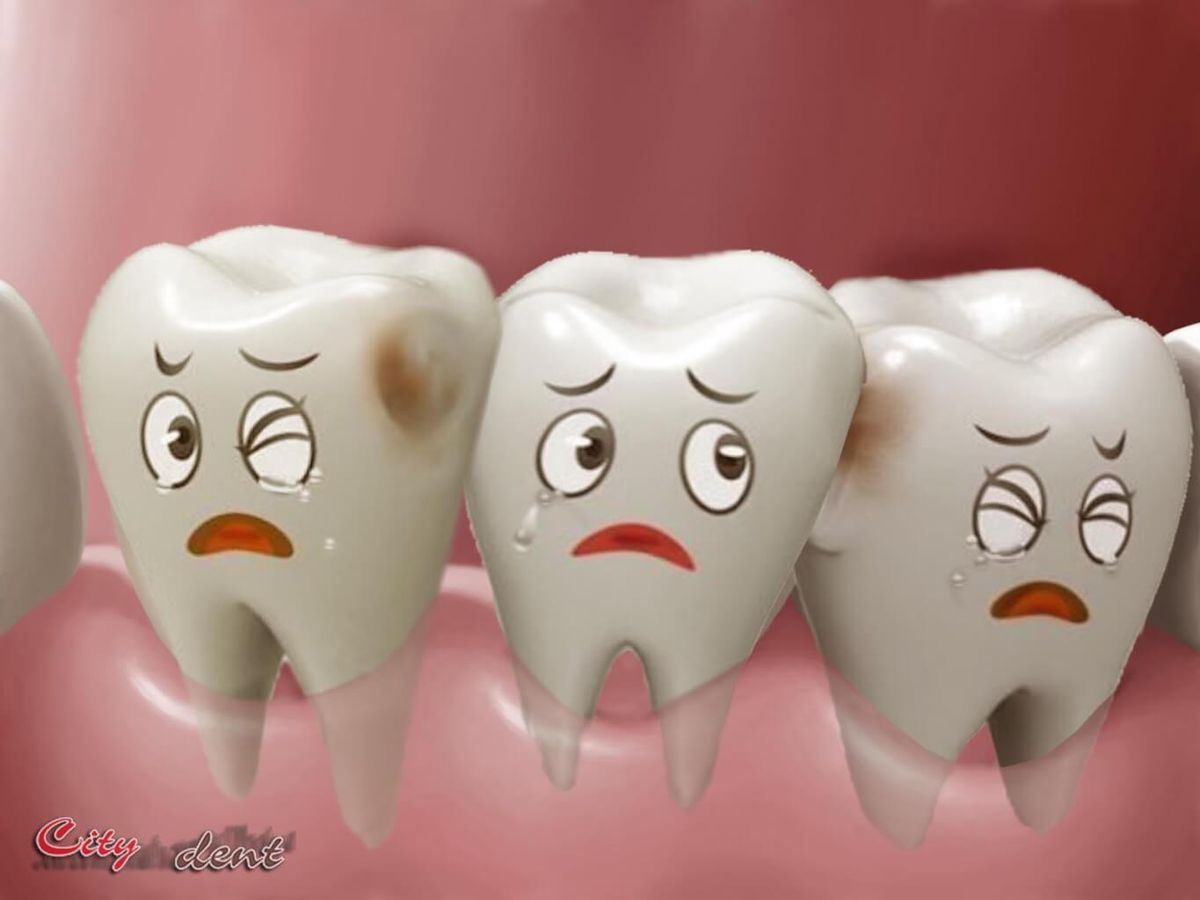 gigi tidak rata pramugari